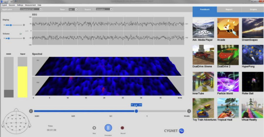 EEG Neurofeedback